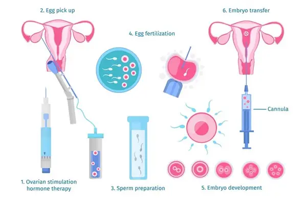 In Vitro Fertilization and Embryo Transfer (IVF-ET)