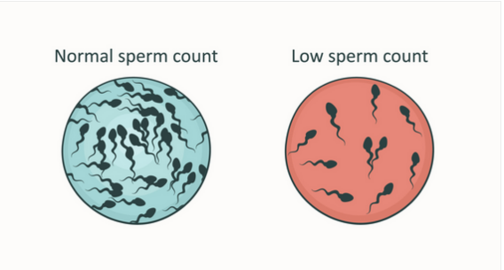 Normal Sperm count vs Low sperm count