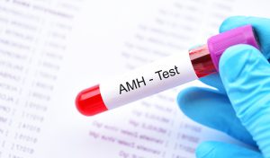 AMH Blood Test: Is it Accurate? How to Interpret the Results
