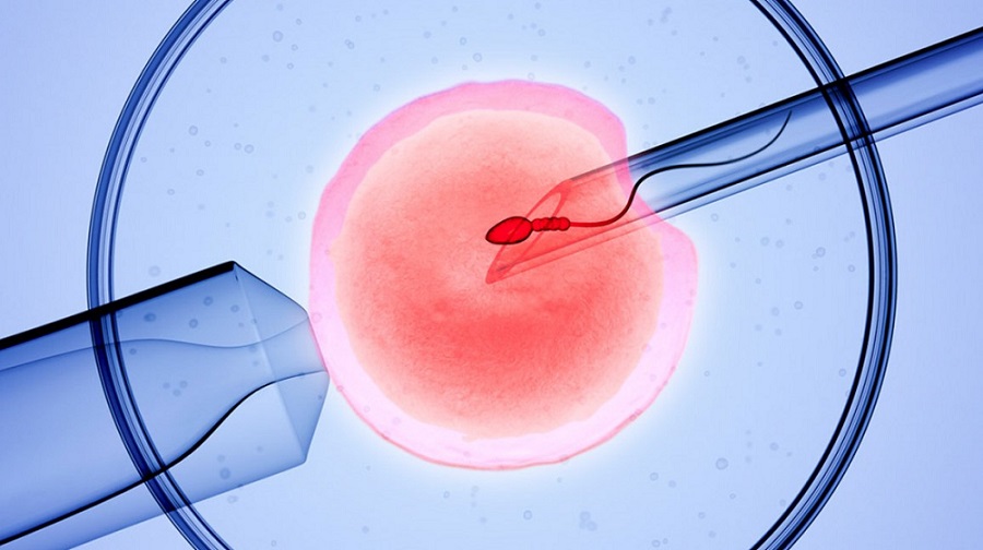 different kinds of ivf treatment 