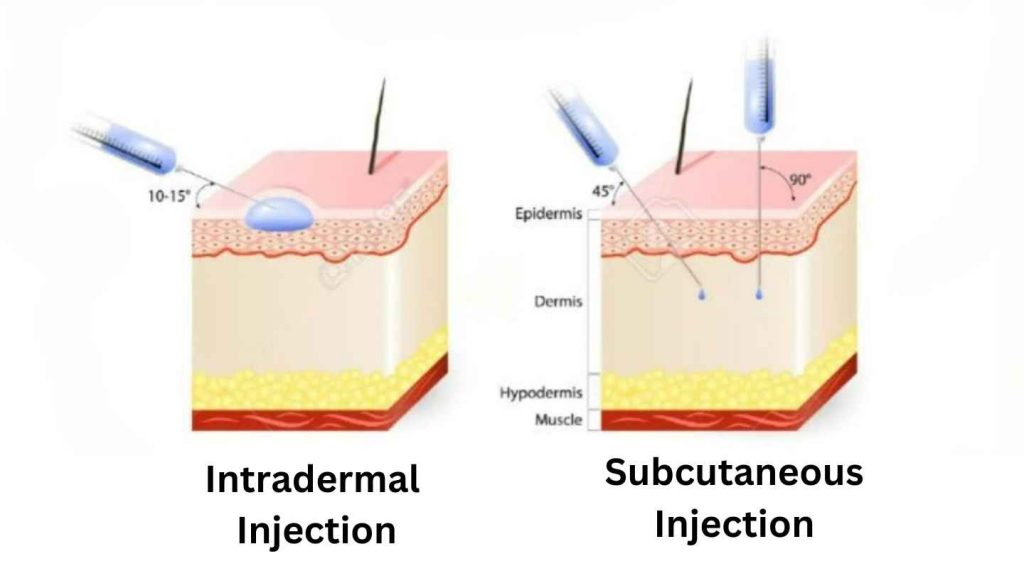 Intradermal Injection and Subcutaneous Injection 