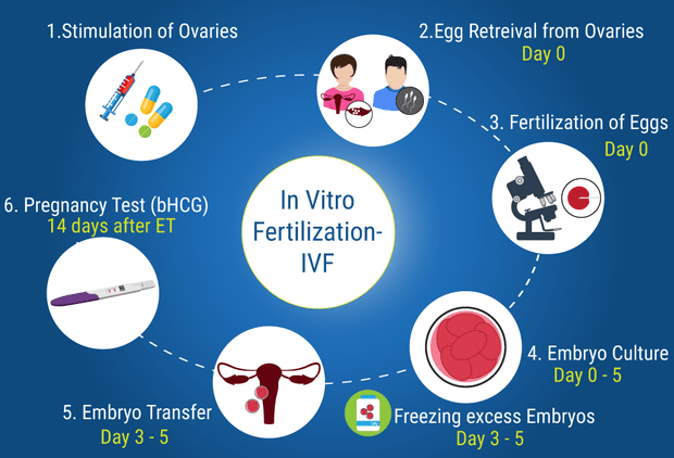 ivf procedure