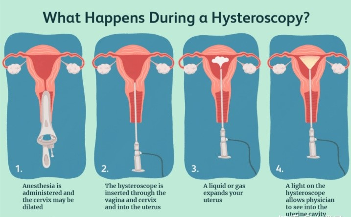 what happens during a during hysteroscopy