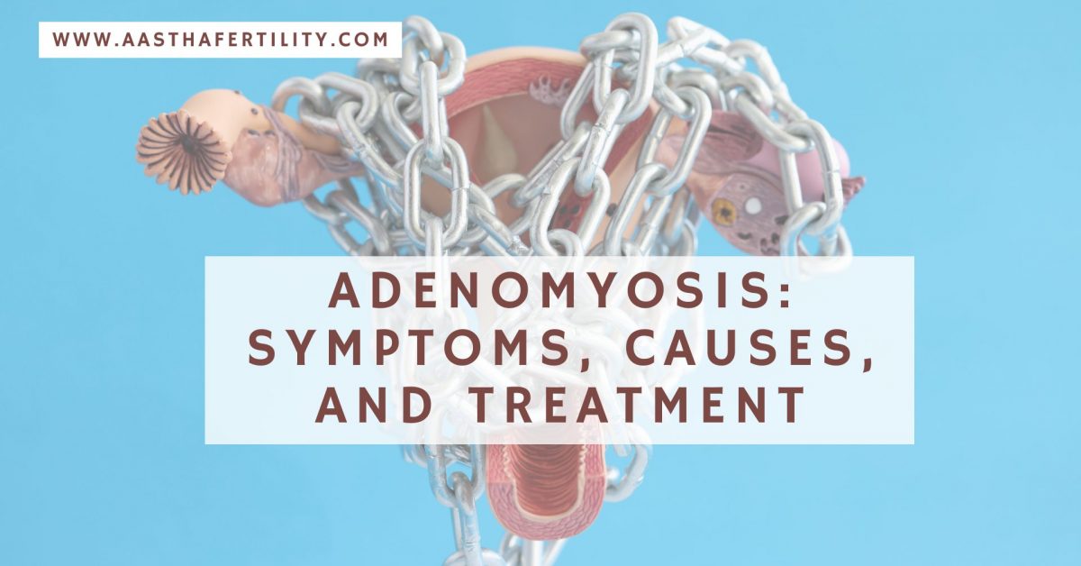 Adenomyosis: Symptoms, Causes, And Treatment