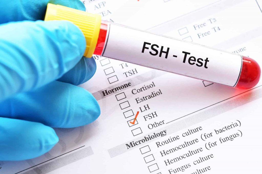 FSH (Follicle Stimulating Hormone) TEST