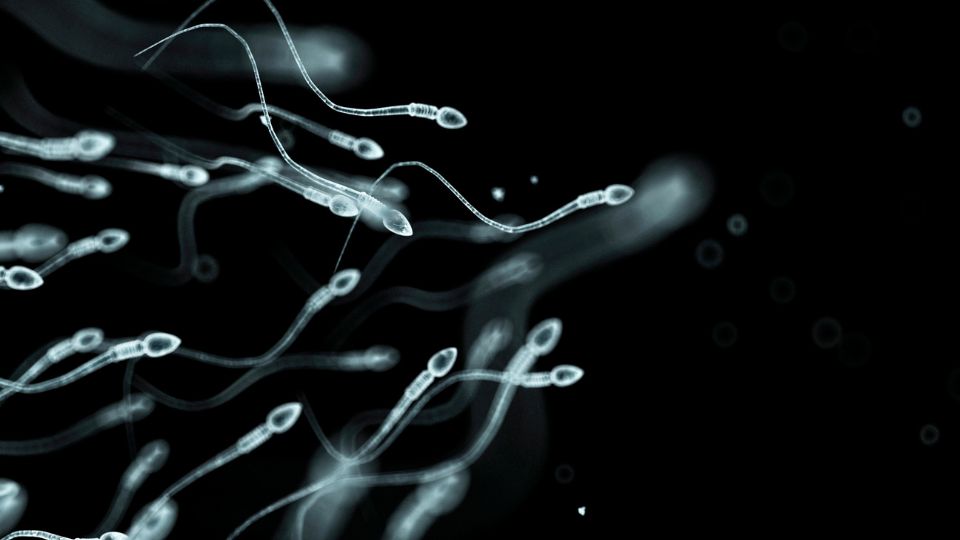 Close-up visualization of sperm cells, with several showing reduced movement, representing low sperm motility.