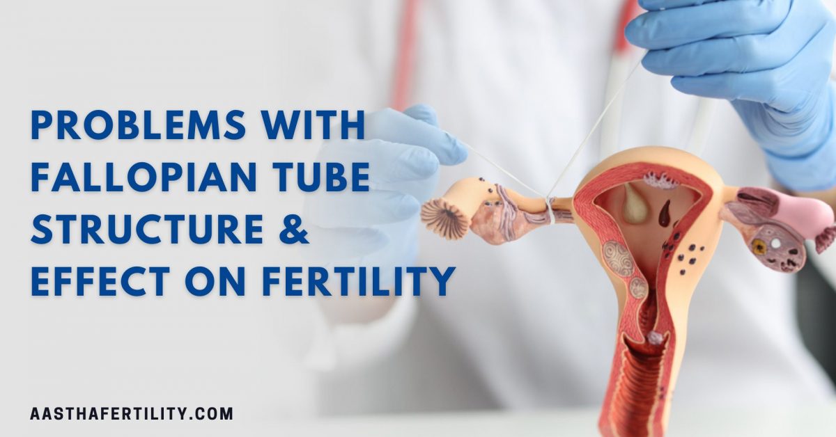Problems with Fallopian Tube Structure & Effect on Fertility