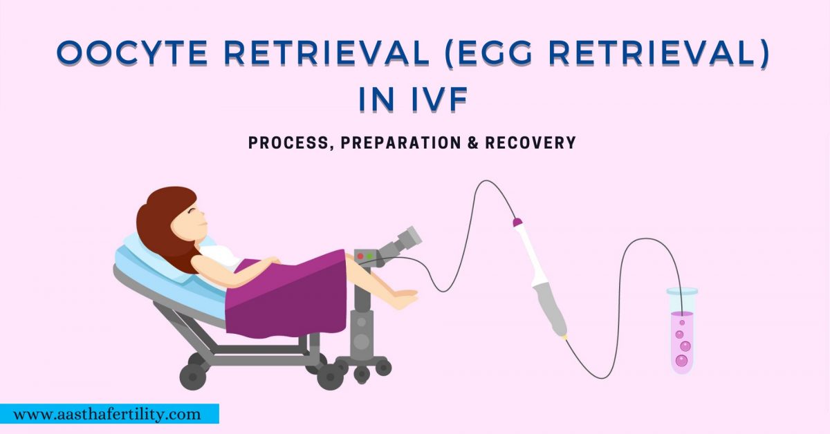 Oocyte Retrieval (Egg Retrieval) in IVF: Process, Preparation & Recovery