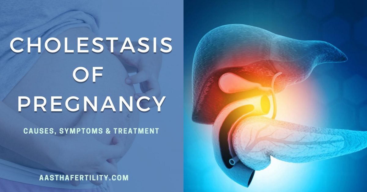 Cholestasis of Pregnancy: Causes, Symptoms & Treatment