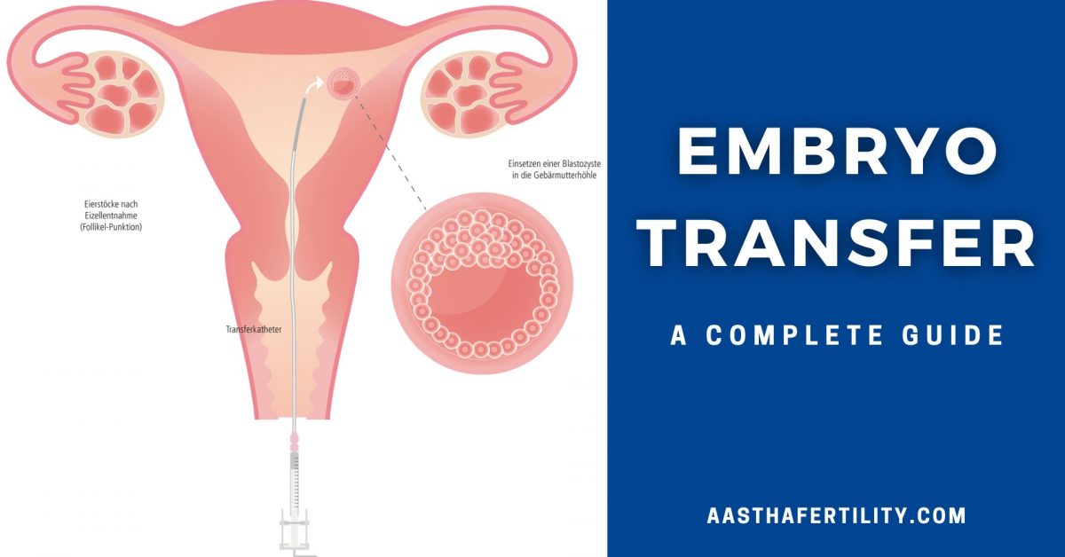 Embryo Transfer- A Complete Guide 2022