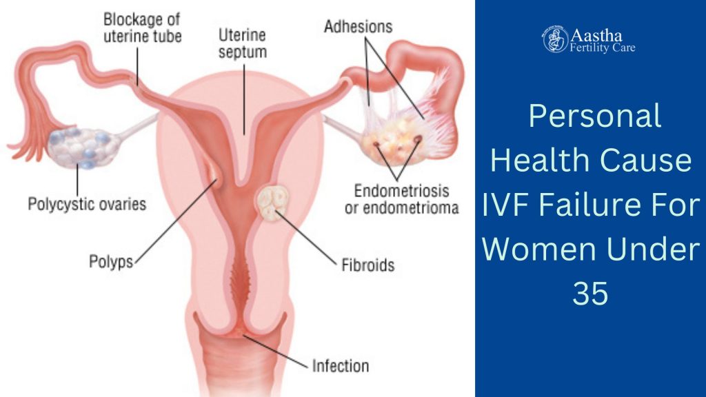 Personal Health Cause IVF Failure For Women Under 35