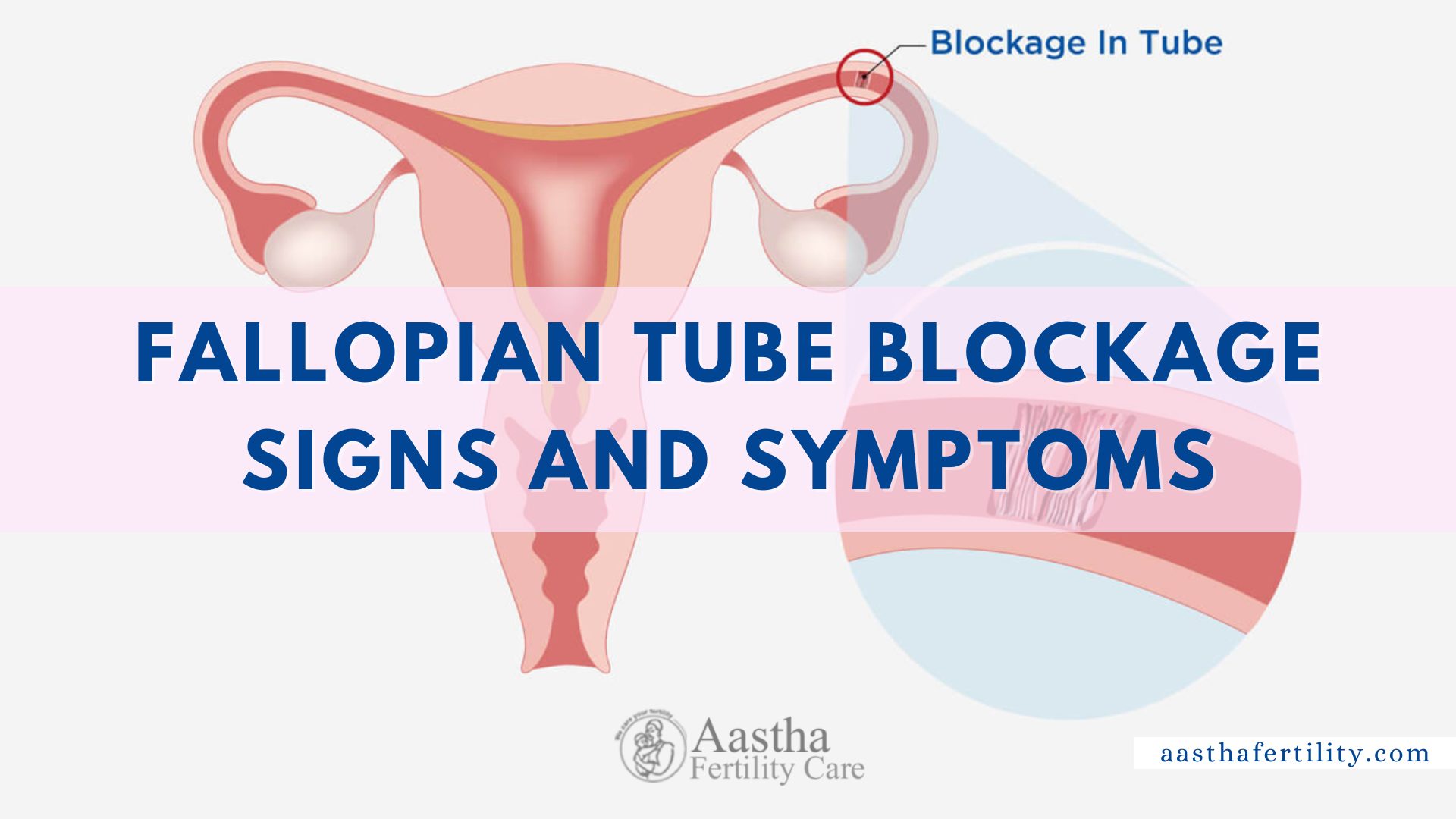 Fallopian Tube Blockage Signs And Symptoms