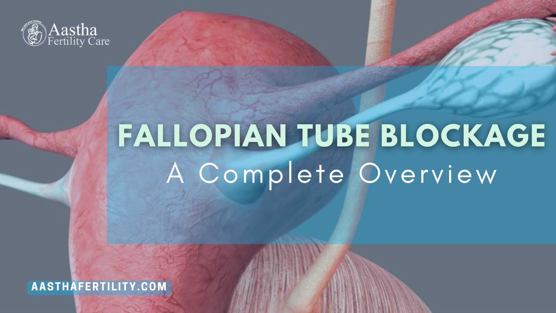 Fallopian Tube Blockage – A Complete Overview