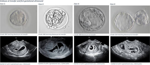 Day 7- fetal development is stable as the embryo continues to grow