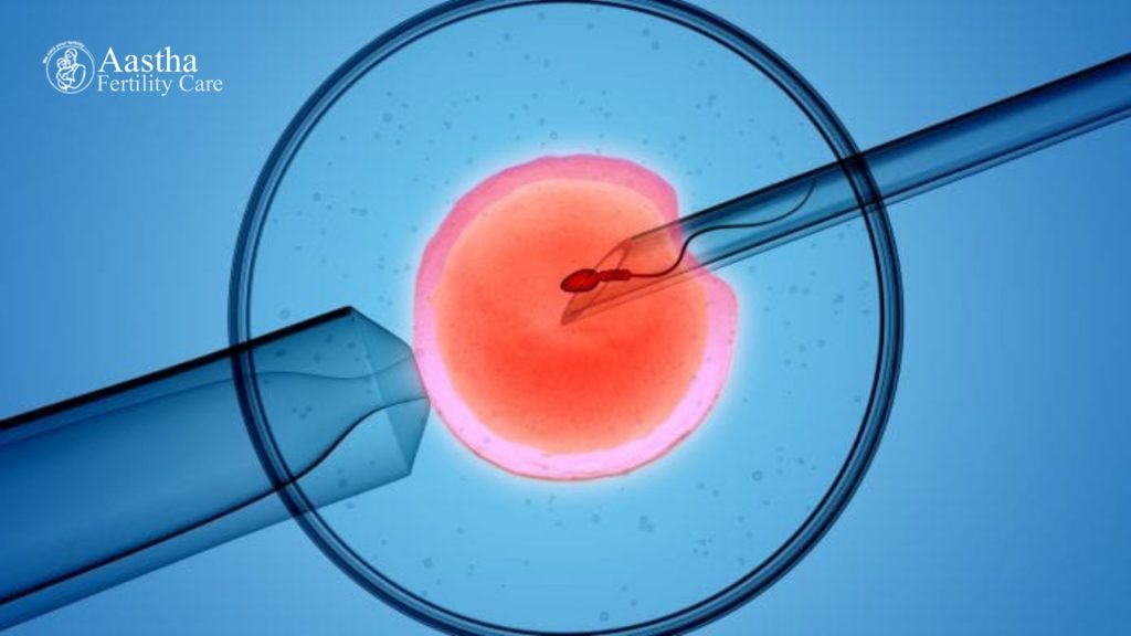 IVF (In-vitro-fertilization)