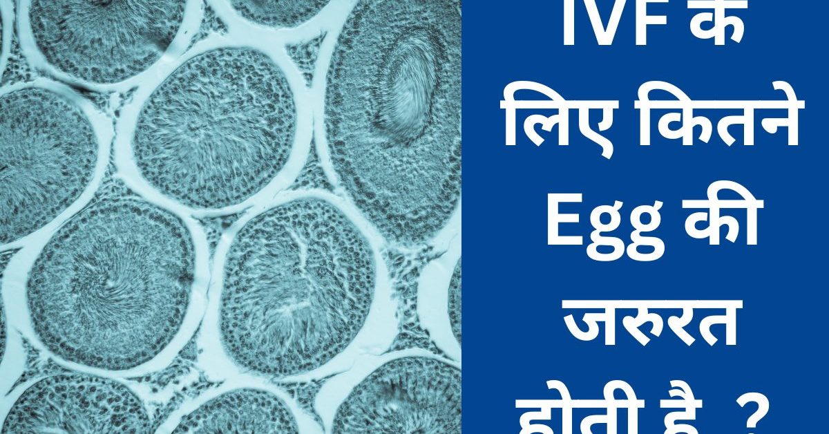IVF के लिए कितने egg चाहिए होते है जानिए पूरी जानकारी