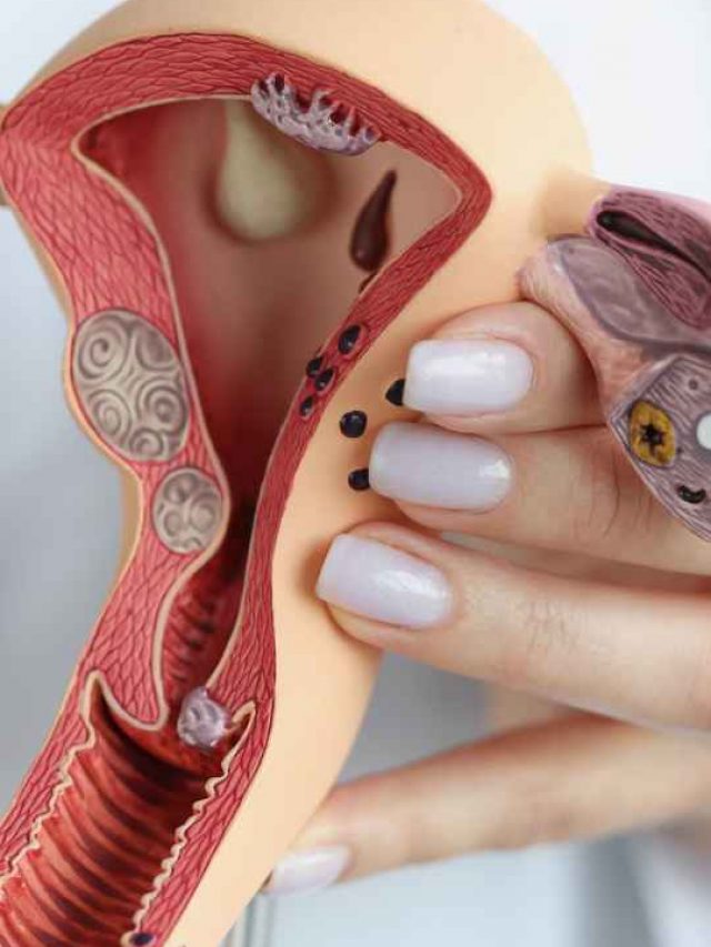 Thin Endometrium: Causes, Symptoms, and Treatment