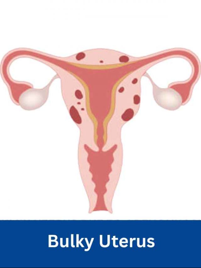 What is Bulky Uterus and Why Does It Occur?