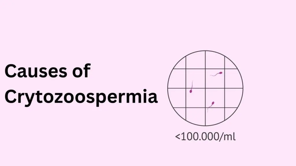 Causes of Cryptozoospermia