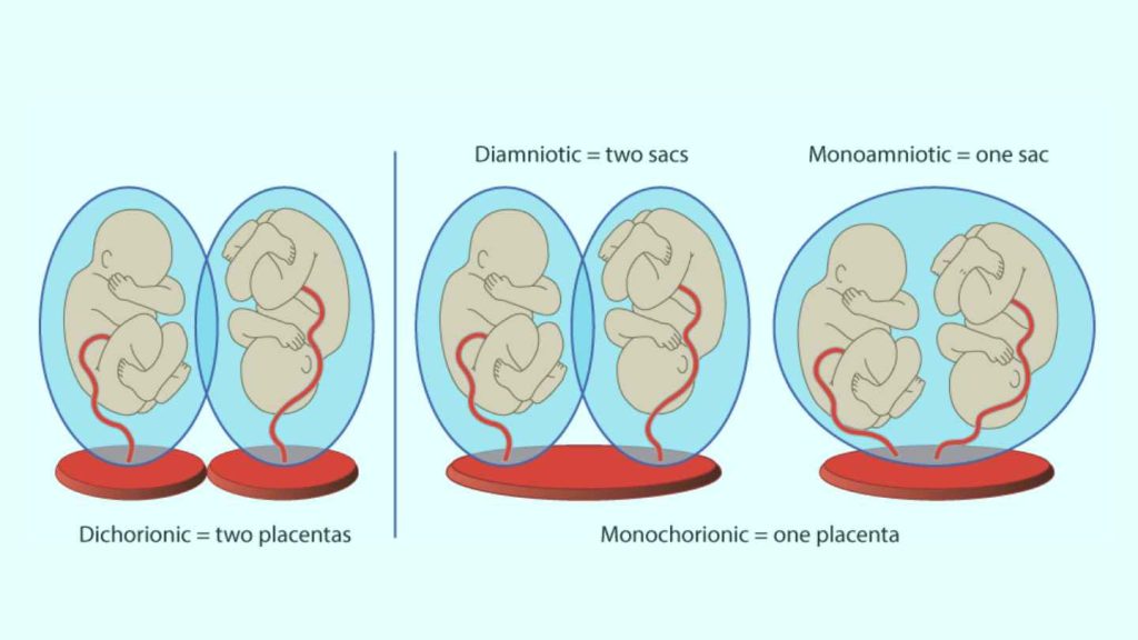 Risk of Multiple Pregnancies