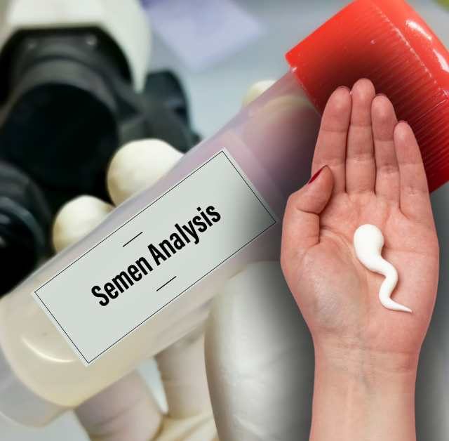 7 Super Foods to Boost Sperm Count