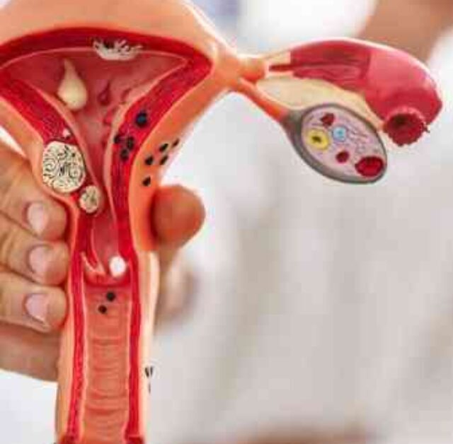 Blocked Fallopian Tube Ka Ilaj – Janiye Asaan Bhaasha Mein