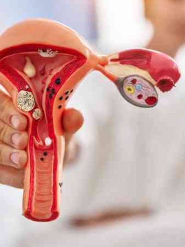 Blocked Fallopian Tube Ka Ilaj – Janiye Asaan Bhaasha Mein