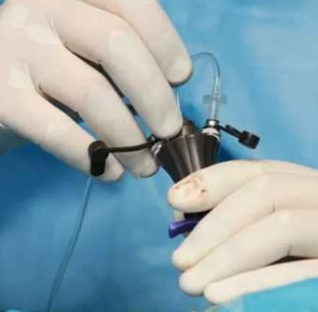 Laparoscopy Kya Hai? Simple Hinglish Guide