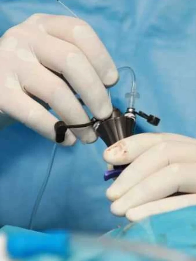 Laparoscopy Kya Hai? Simple Hinglish Guide