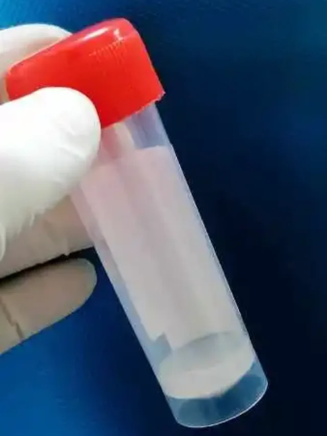Average Sperm Count by Age