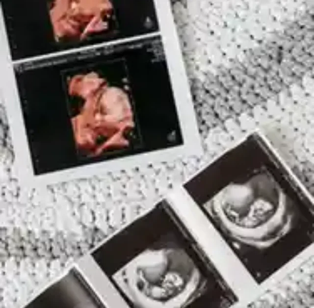 3-Month Pregnancy: What to Expect
