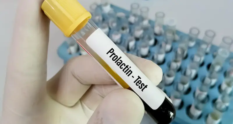Prolactin Test in Hindi: क्या है और कब कराना चाहिए??