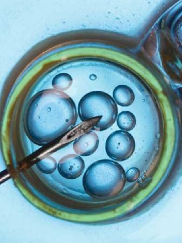 Different Types of IVF: Which One’s Right for You?