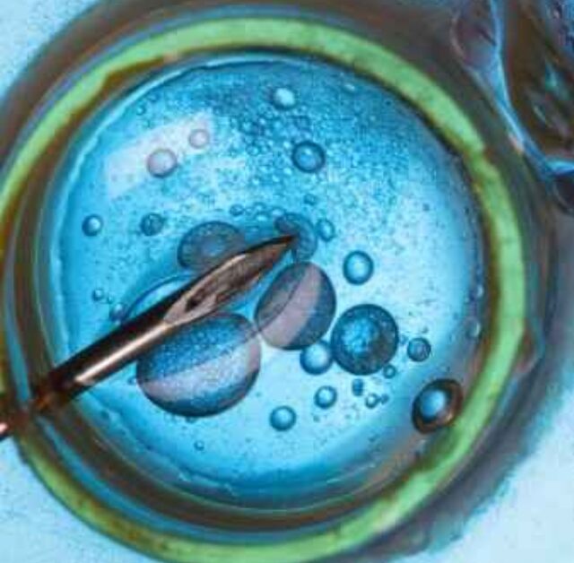 IVF Failure Reasons — Why IVF May Not Succeed