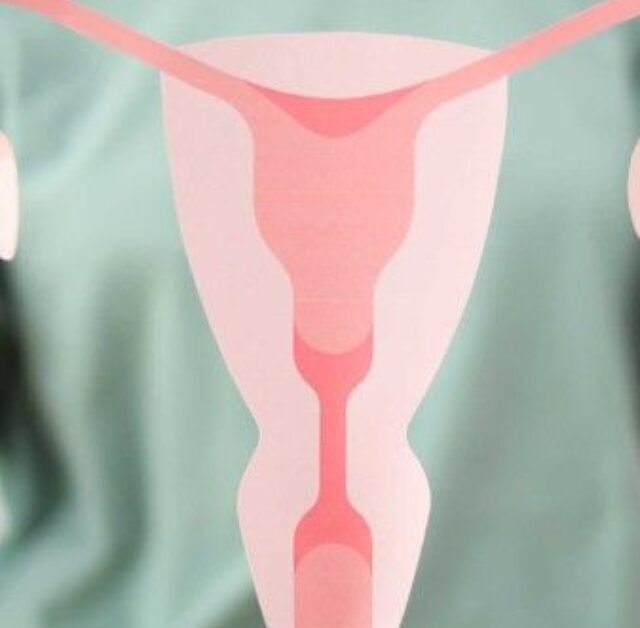 Causes of Inflammation in PCOS – What You Should Know
