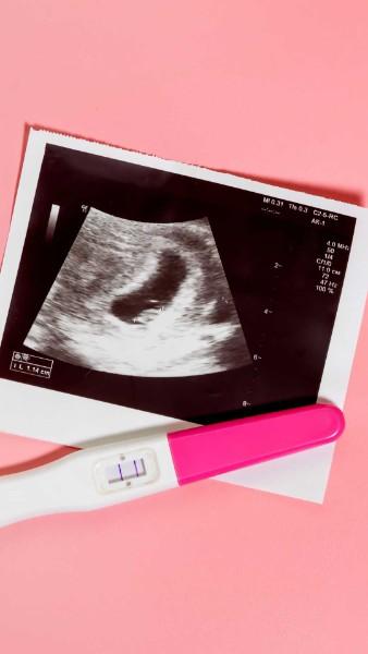 Who should visit IVF clinic in Jaipur