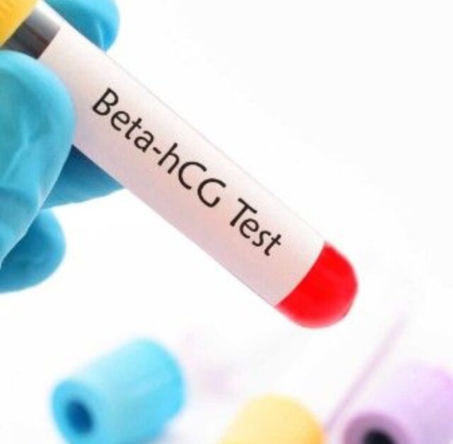 Beta HCG Test Explained | Pregnancy Hormone & Normal Levels