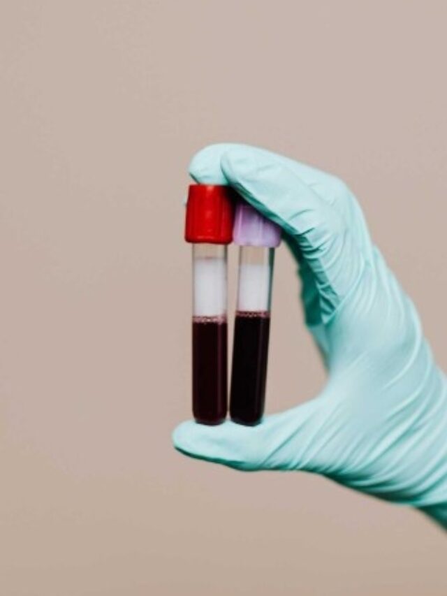 HSG Test for Fertility: Procedure, Benefits & What to Expect
