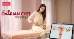 right ovarian cyst in hindi