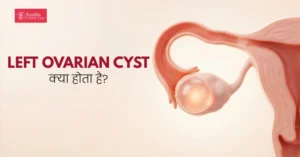 left ovarian cyst in hindi