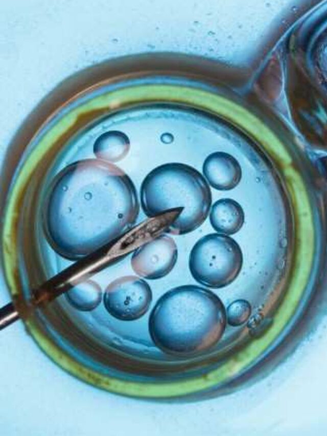 IVF Process Step by Step Explained — Complete Guide